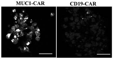 Method for evaluating effectiveness of chimeric antigen receptor-T (CAR-T) cells