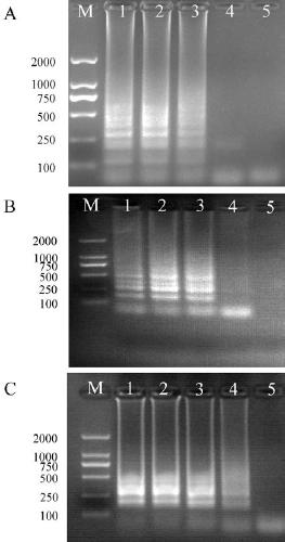 A set of loop-mediated isothermal amplification primers and their kits for the identification of three species of Brachybody nematodes on sugarcane
