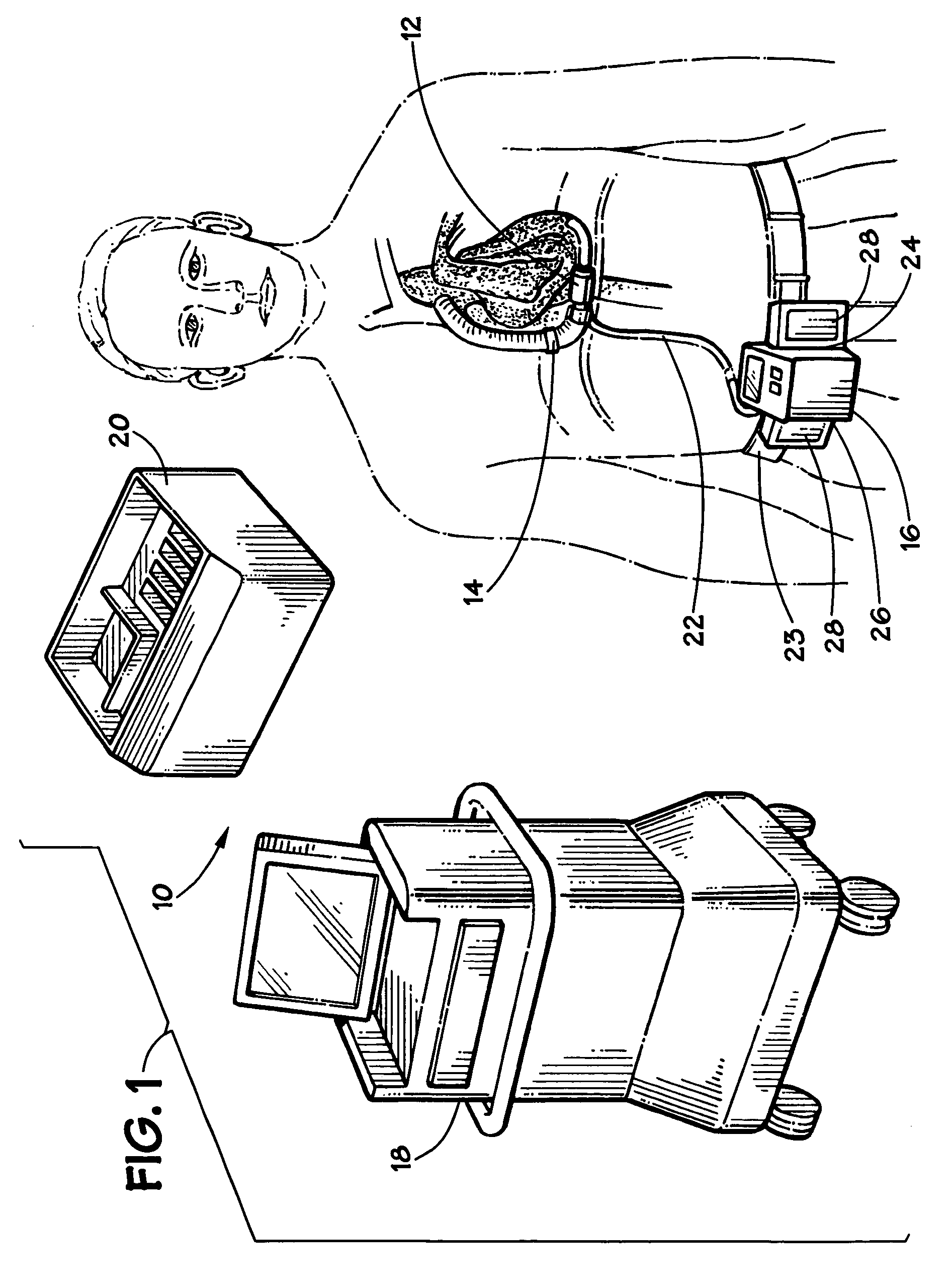 Blood pump system and method of operation