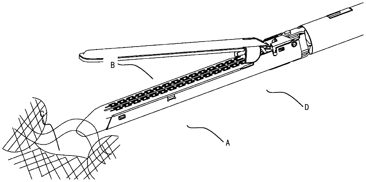 Endoscopic stapling device