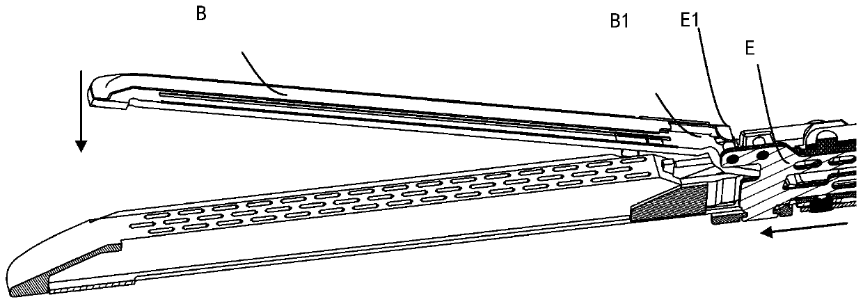 Endoscopic stapling device