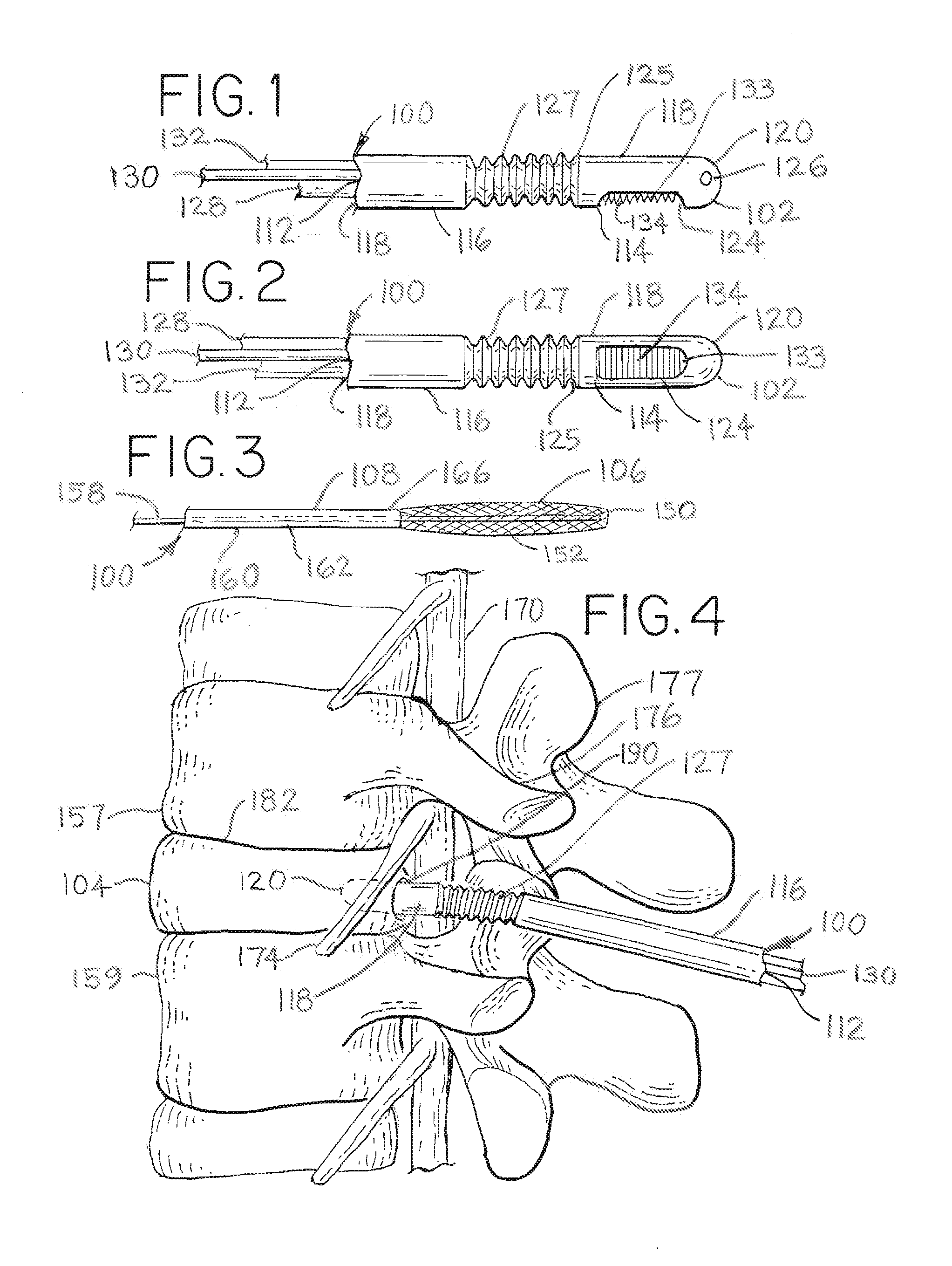 Minimally Invasive Surgical (MIS) Technique and System for Performing an Interbody Lumbar Fusion with a Navigatable Intervertebral Disc Removal Device and Collapsible Intervertebral Device