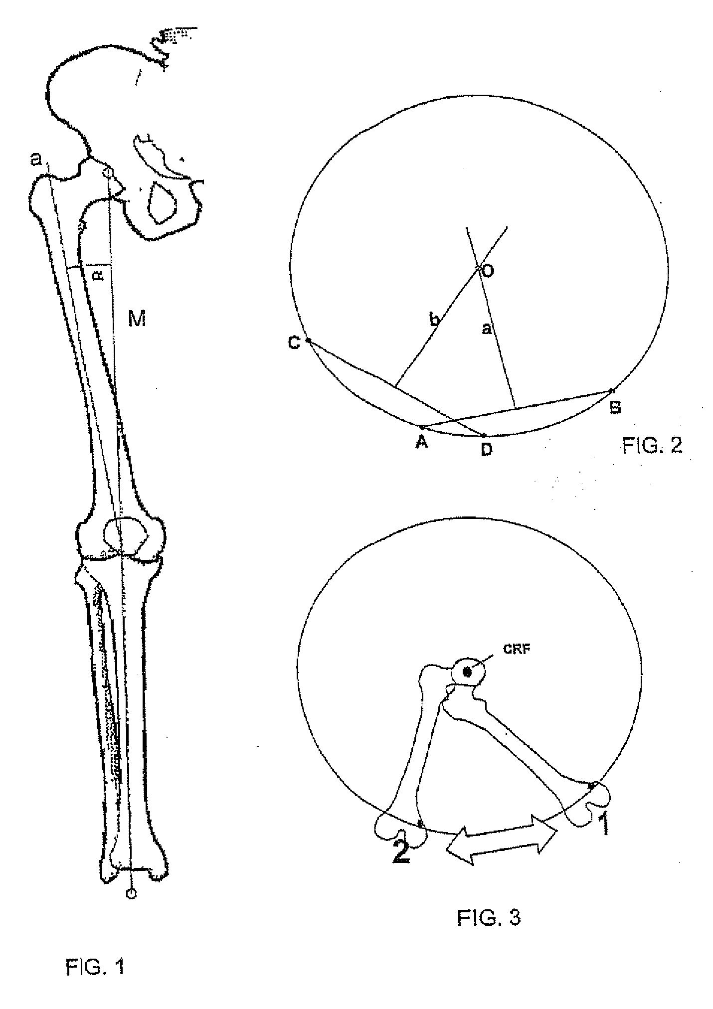 Sighting instrument for determining the mechanical axis of the femur