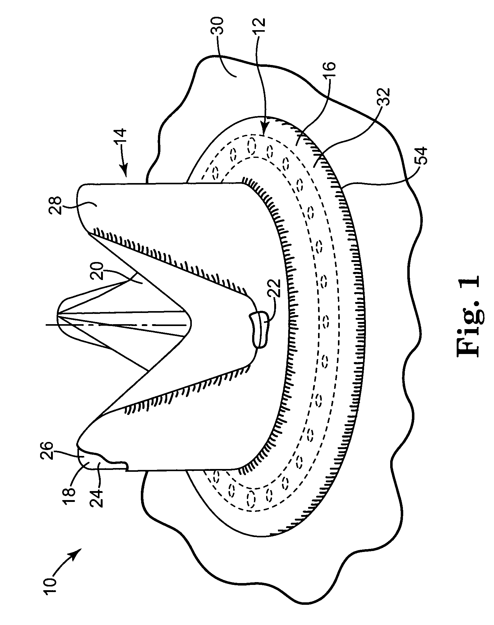 Pharmacological delivery implement for use with cardiac repair devices