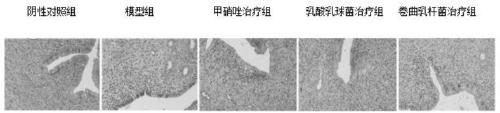 Construction method of lactococcus lactis MG1363 and application of lactococcus lactis MG1363 in treating bacterial vaginitis