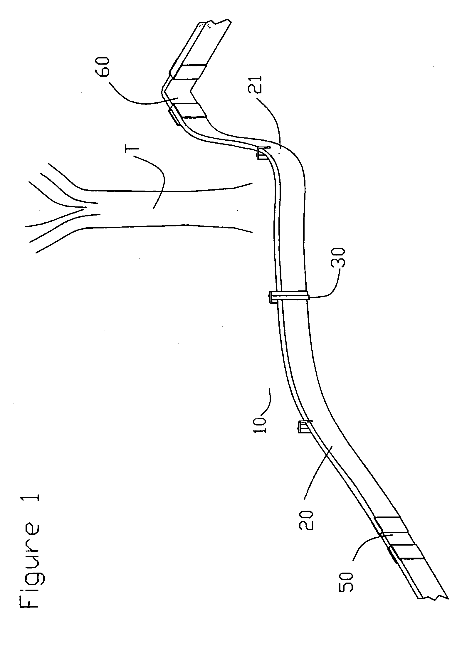 Fiberglass lawn edging