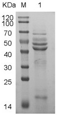 Egg yolk antibody for resisting antigen excreted and secreted by trichina as well as preparation method and application of egg yolk antibody