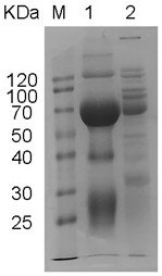 Egg yolk antibody for resisting antigen excreted and secreted by trichina as well as preparation method and application of egg yolk antibody