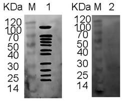 Egg yolk antibody for resisting antigen excreted and secreted by trichina as well as preparation method and application of egg yolk antibody