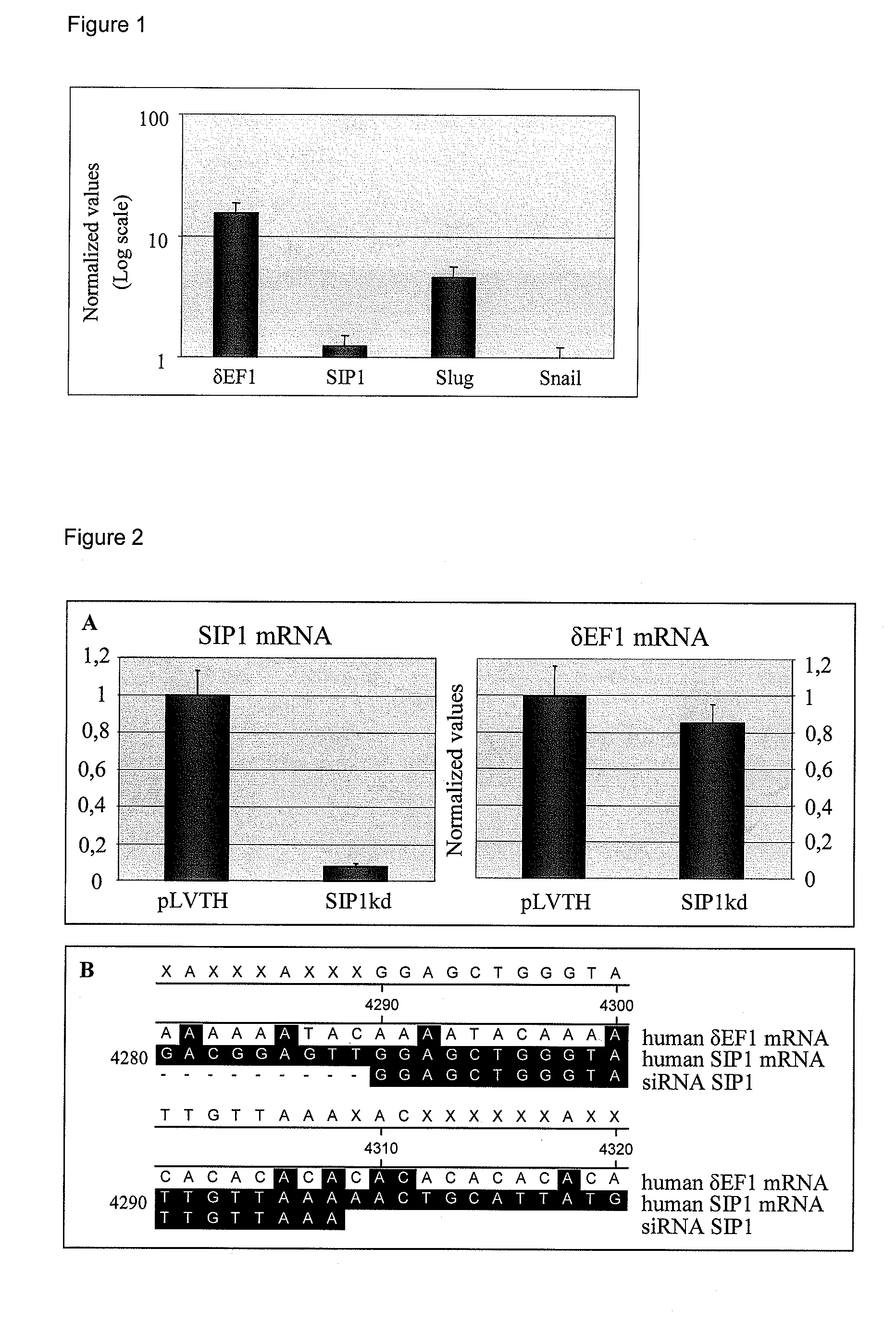 Use of sip1 as determinant of breast cancer stemness