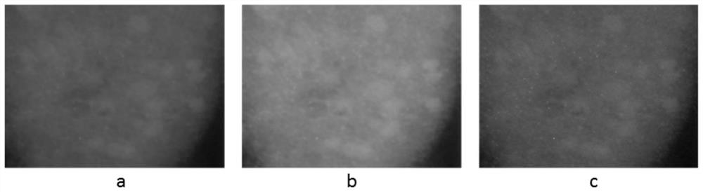 Enhancement method for ultraviolet fluorescence image of skin disease