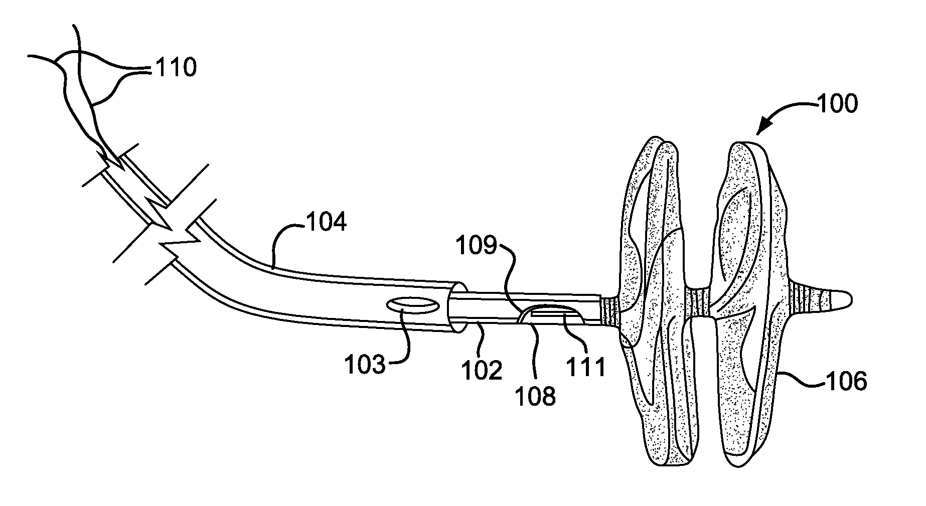 Sealing Device and Delivery System