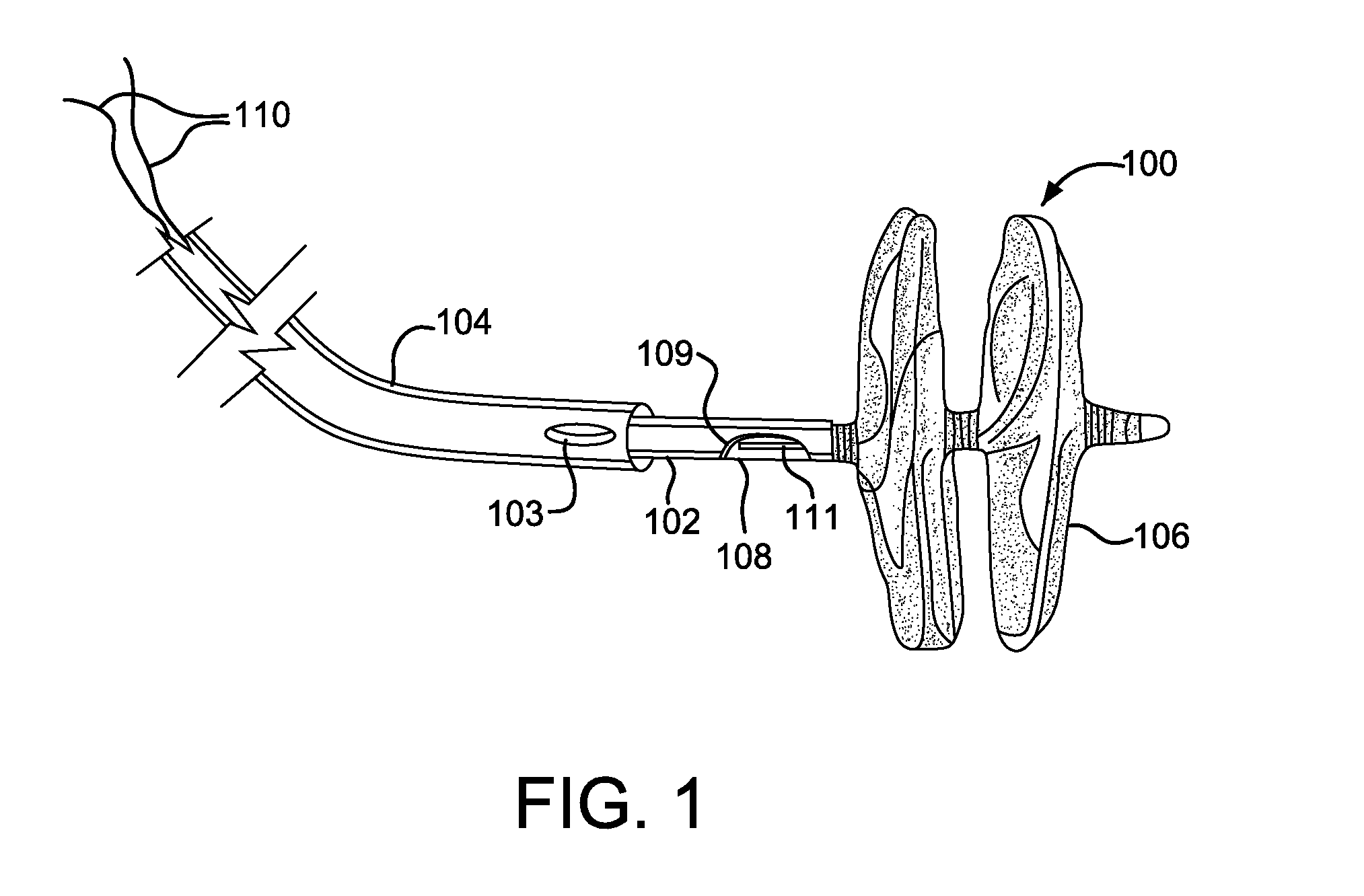 Sealing Device and Delivery System