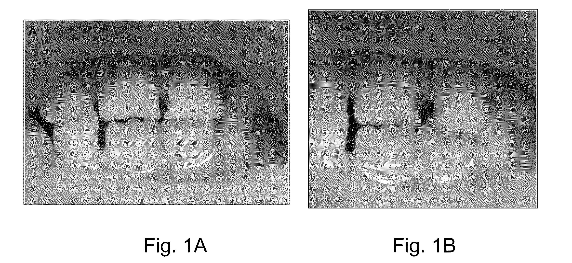 Methods and compositions for preventing caries