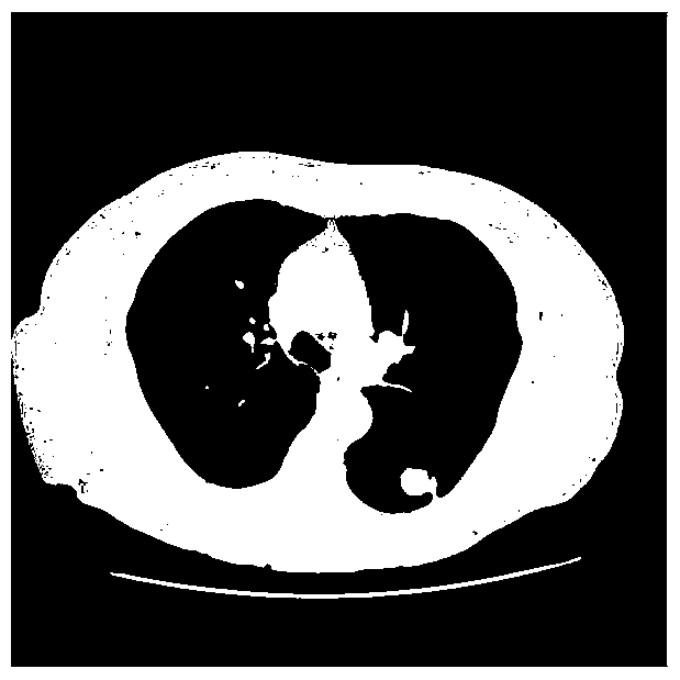 Image Segmentation Method, Pulmonary Nodule Detection Method and Computer Aided Detection System
