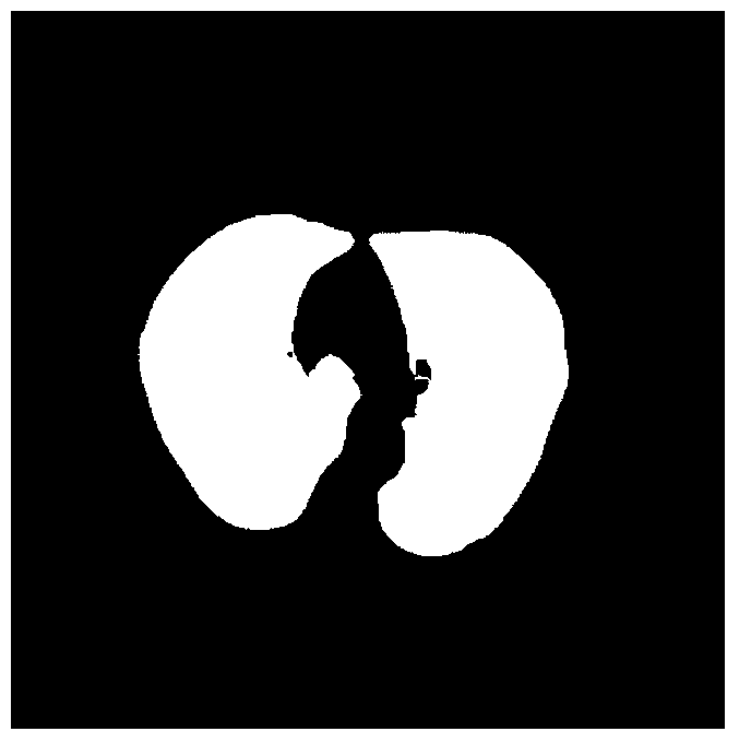 Image Segmentation Method, Pulmonary Nodule Detection Method and Computer Aided Detection System