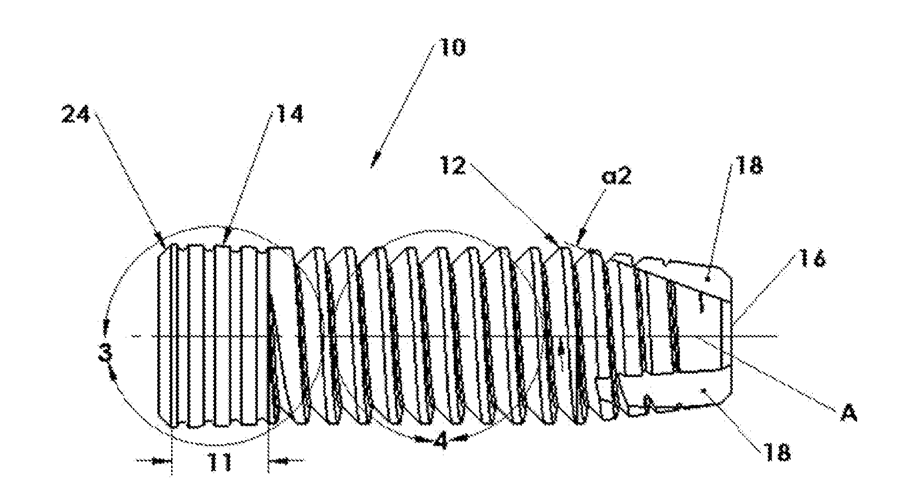 Digital Abutment For Dental Implant System