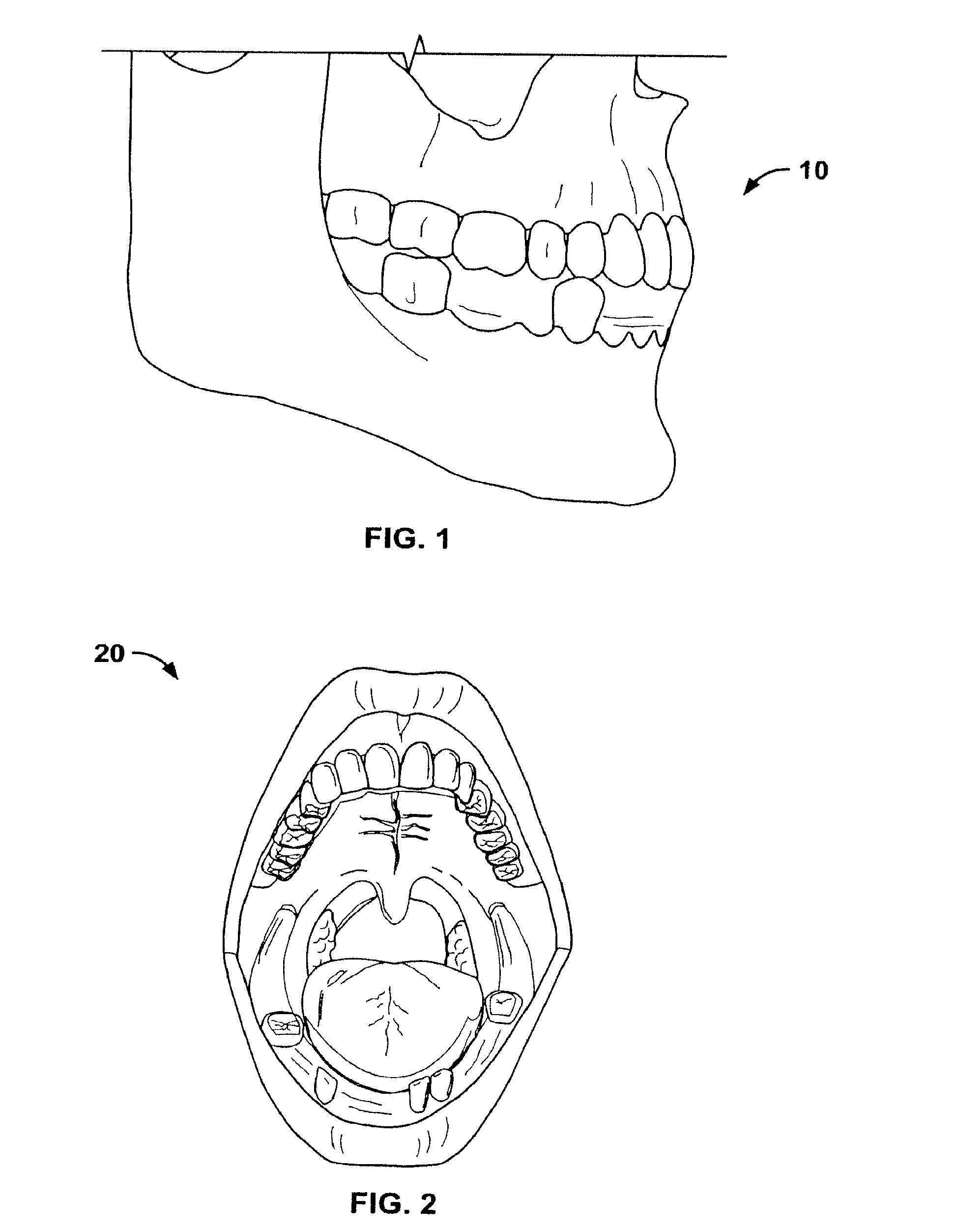 Method For Pre-Operative Visualization Of Instrumentation Used With A Surgical Guide For Dental Implant Placement
