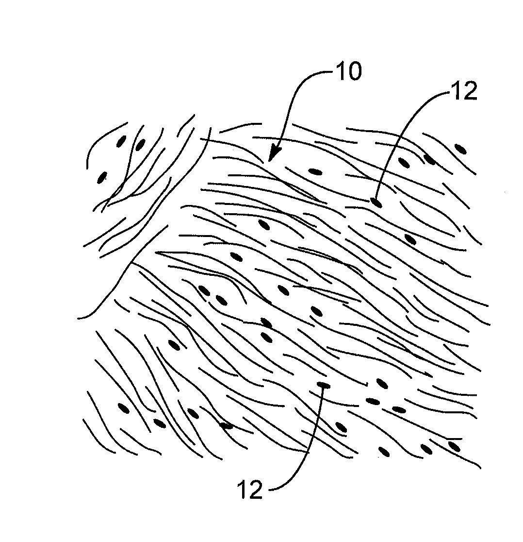Methods and compositions for removing a foreign body from a host