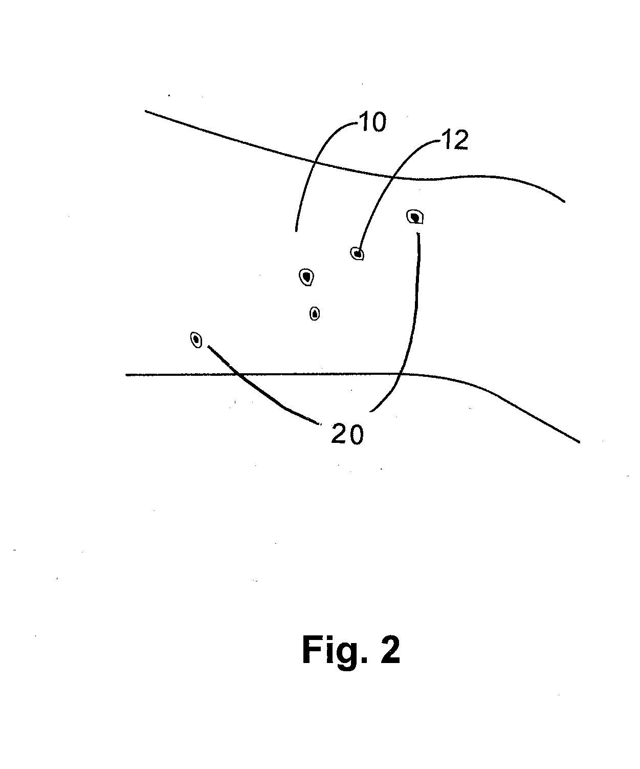 Methods and compositions for removing a foreign body from a host