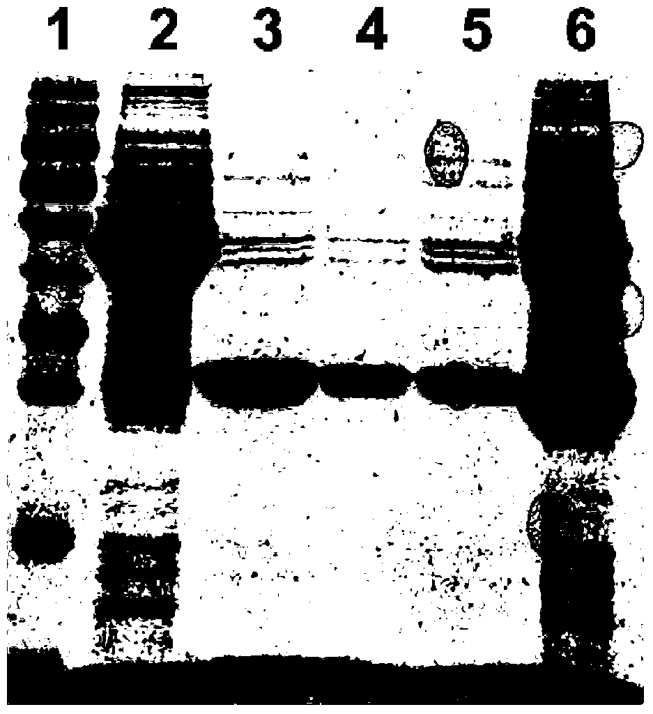 Pseudomonas aeruginosa recombinant protein vac11 and its preparation method and application