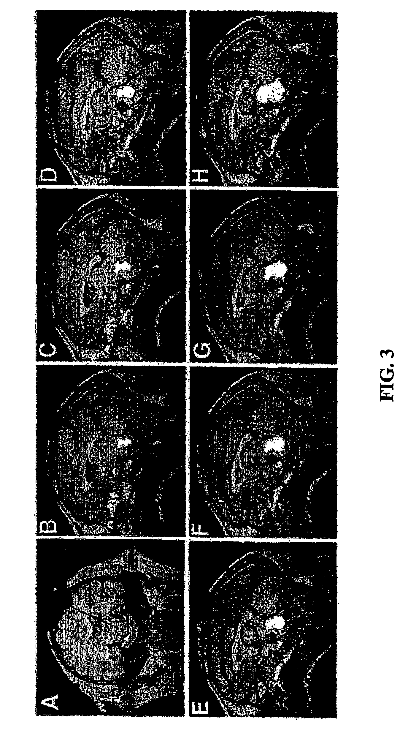Method for convection enhanced delivery of therapeutic agents
