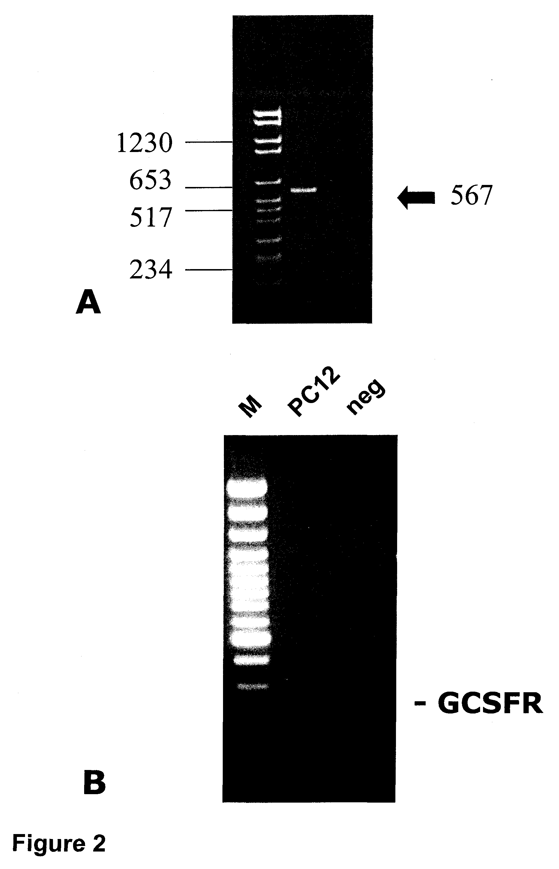 Methods of treating neurological conditions with hematopeitic growth factors