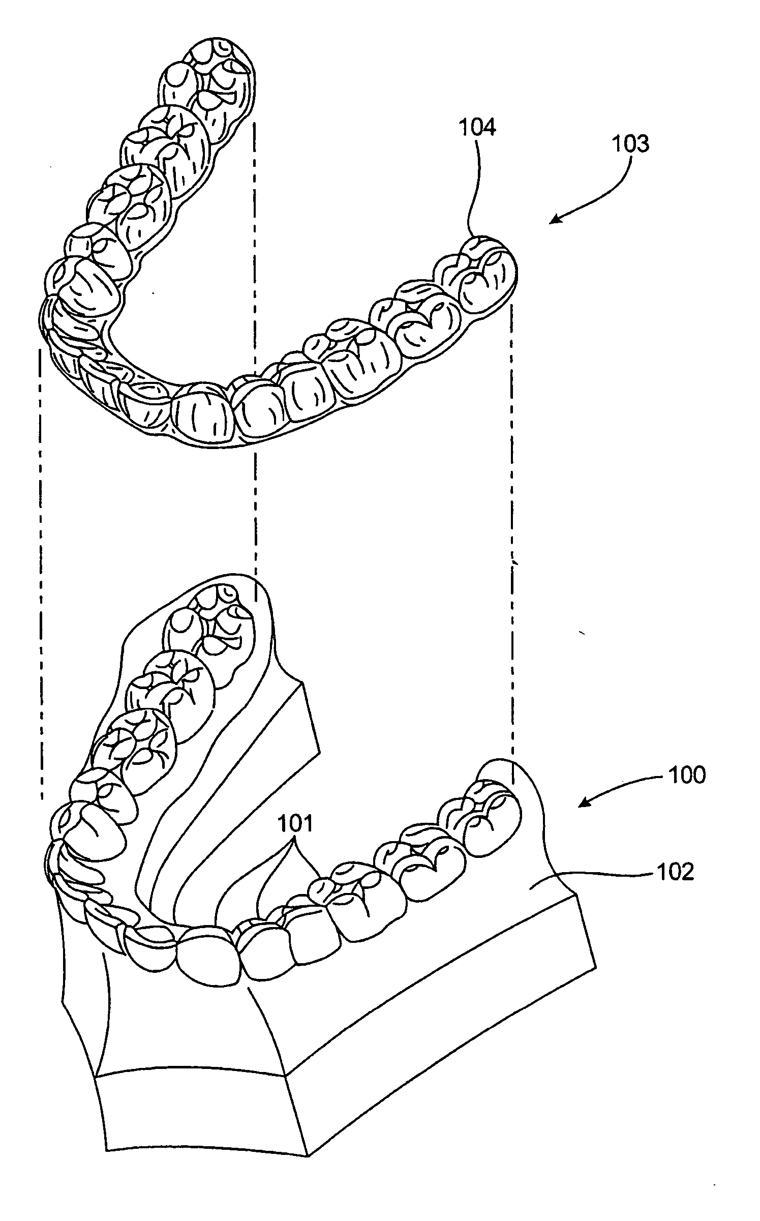 Methods for correcting tooth movements midcourse in treatment