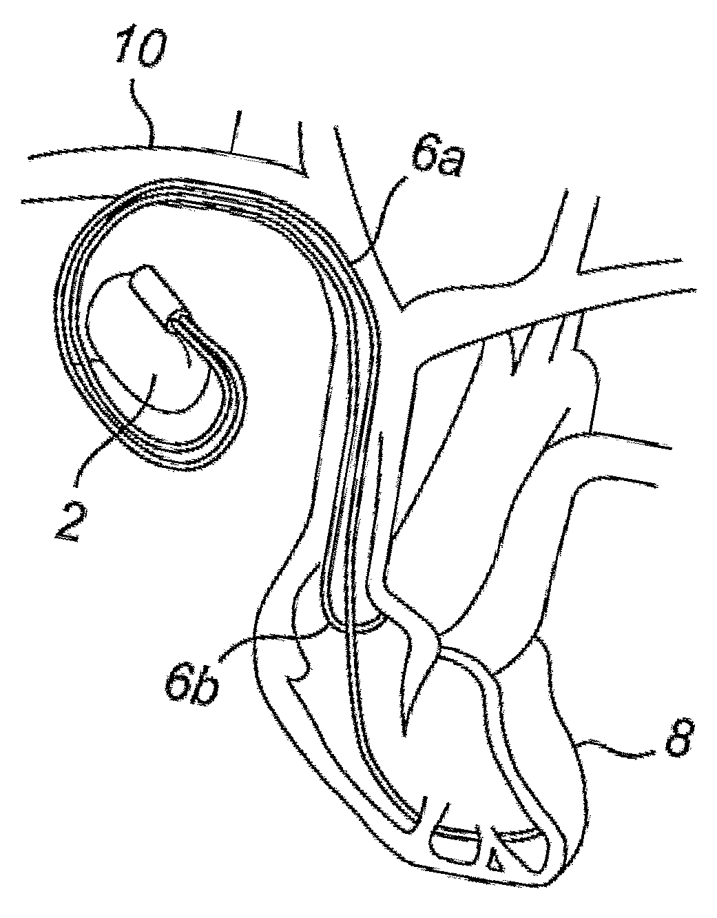 Dual chamber pacemaker