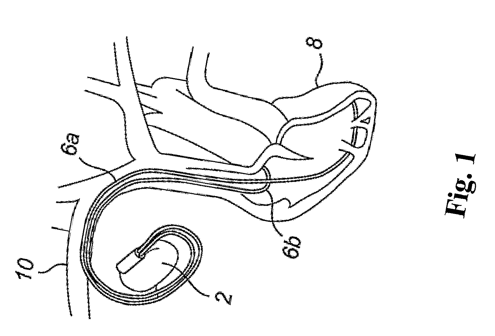 Dual chamber pacemaker