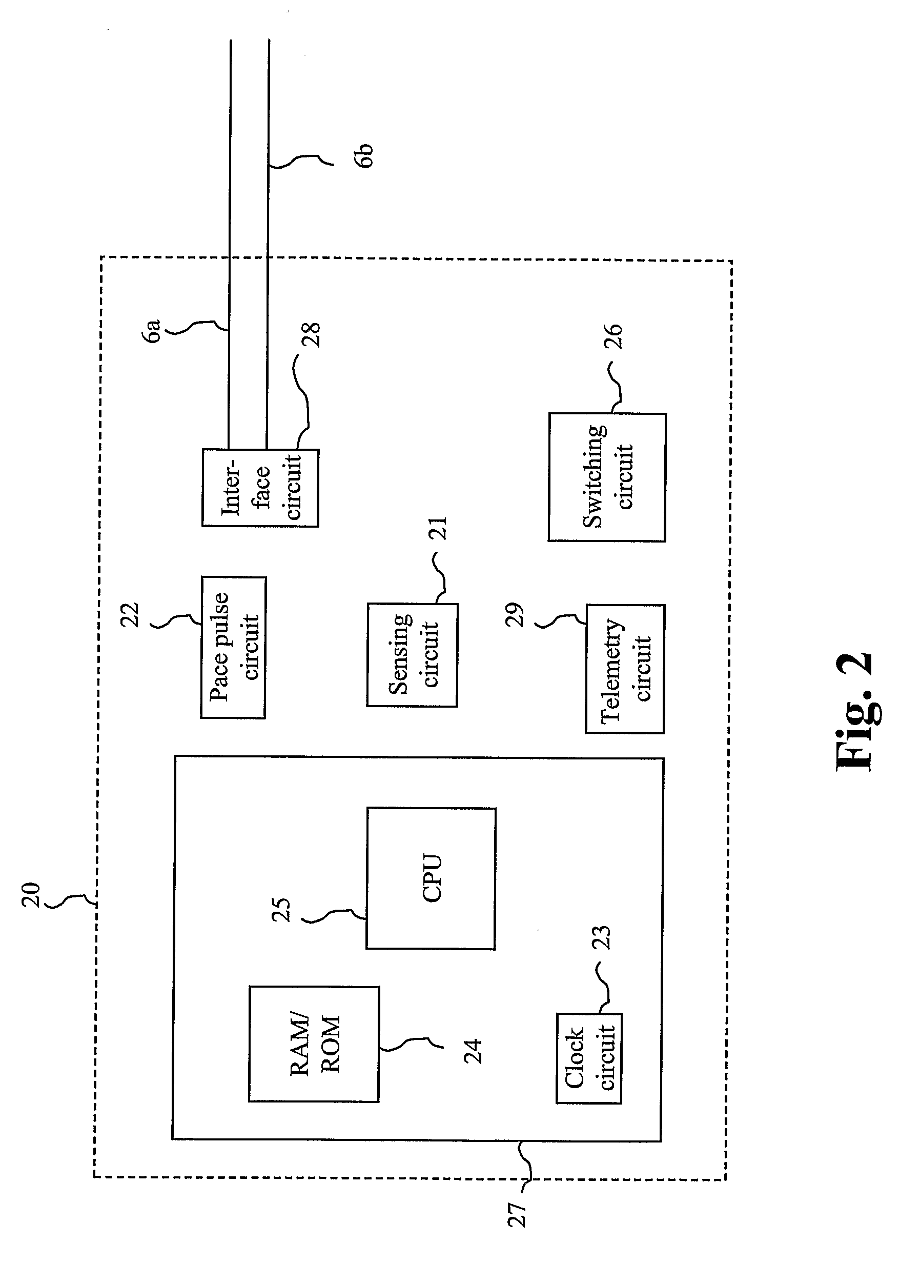 Dual chamber pacemaker