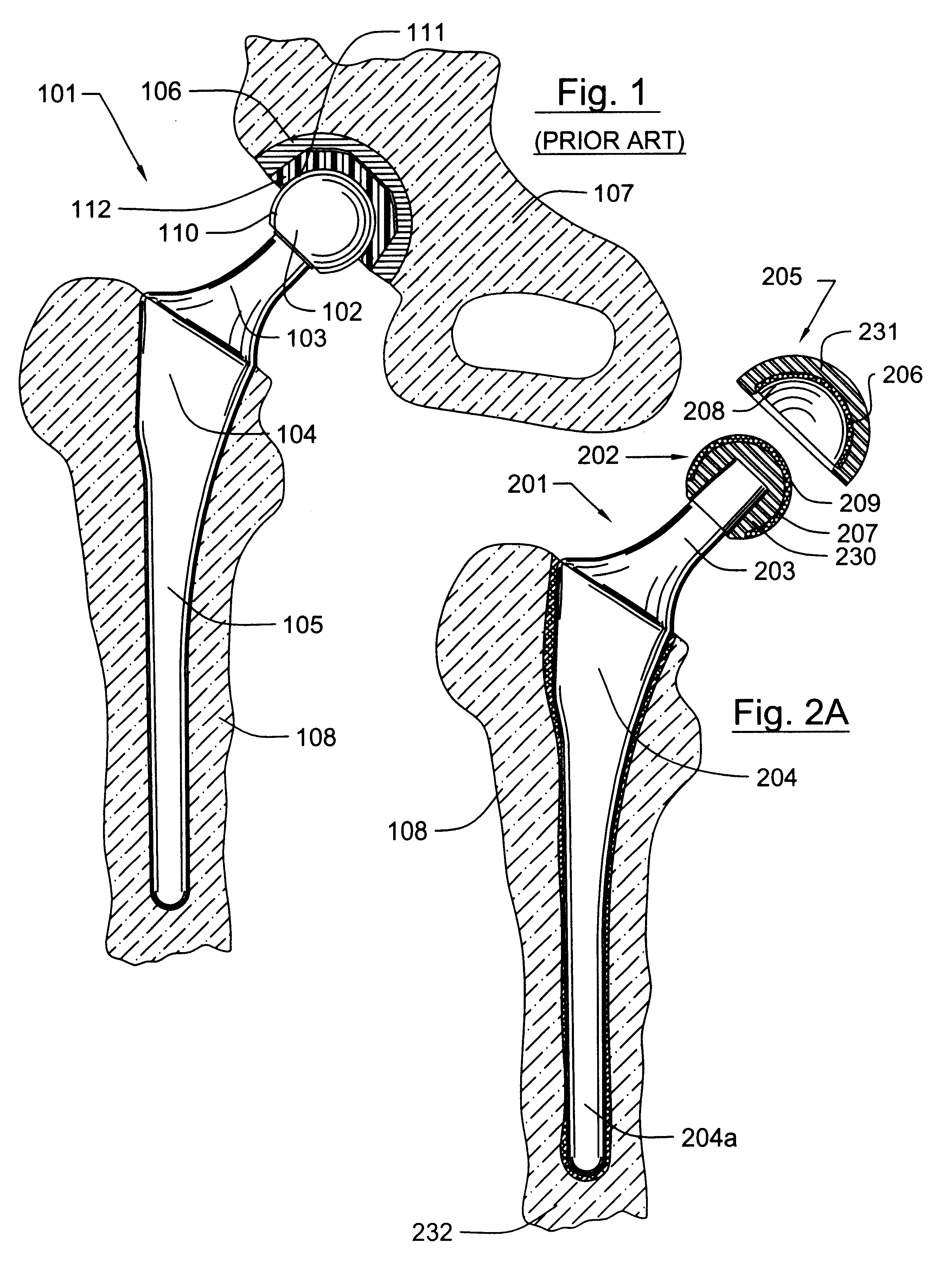 Methods for manufacturing a diamond prosthetic joint component