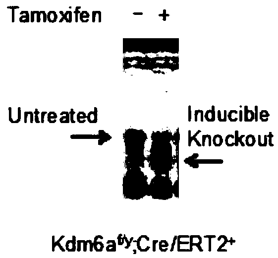 Purpose of histone demethylase KDM6A inhibitor to preparation of obesity treatment medicines