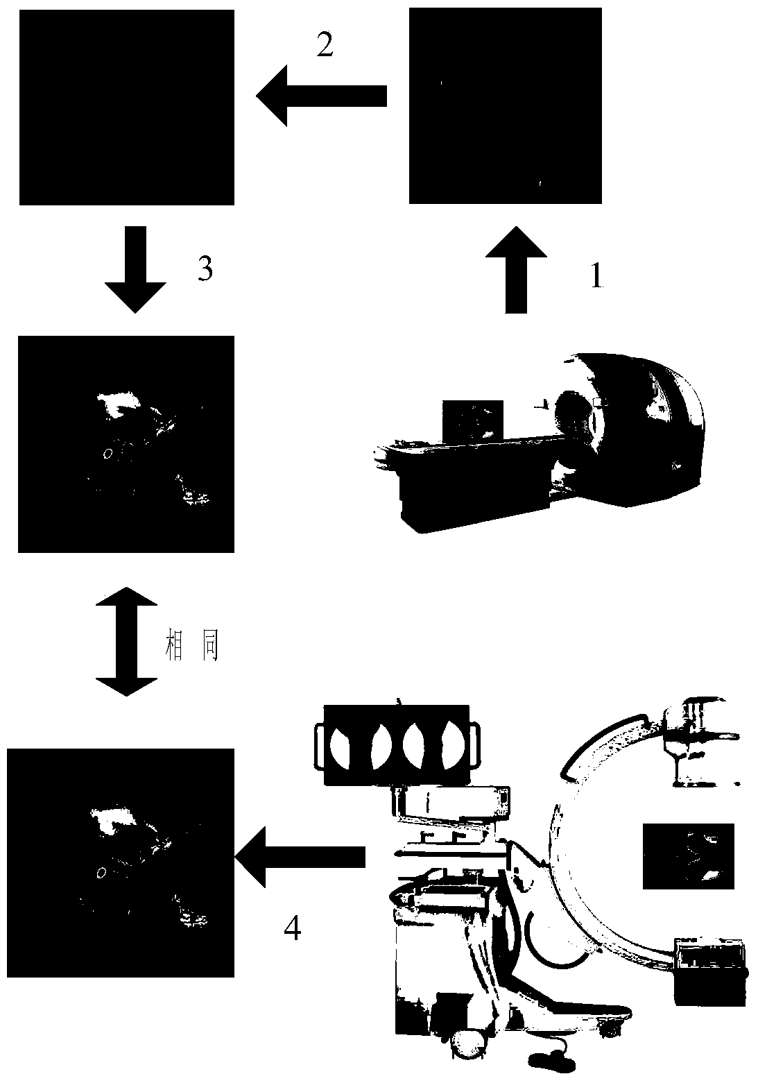 Method for fully corresponding fusion of pre-operation CT data and intraoperative X-ray radiograph