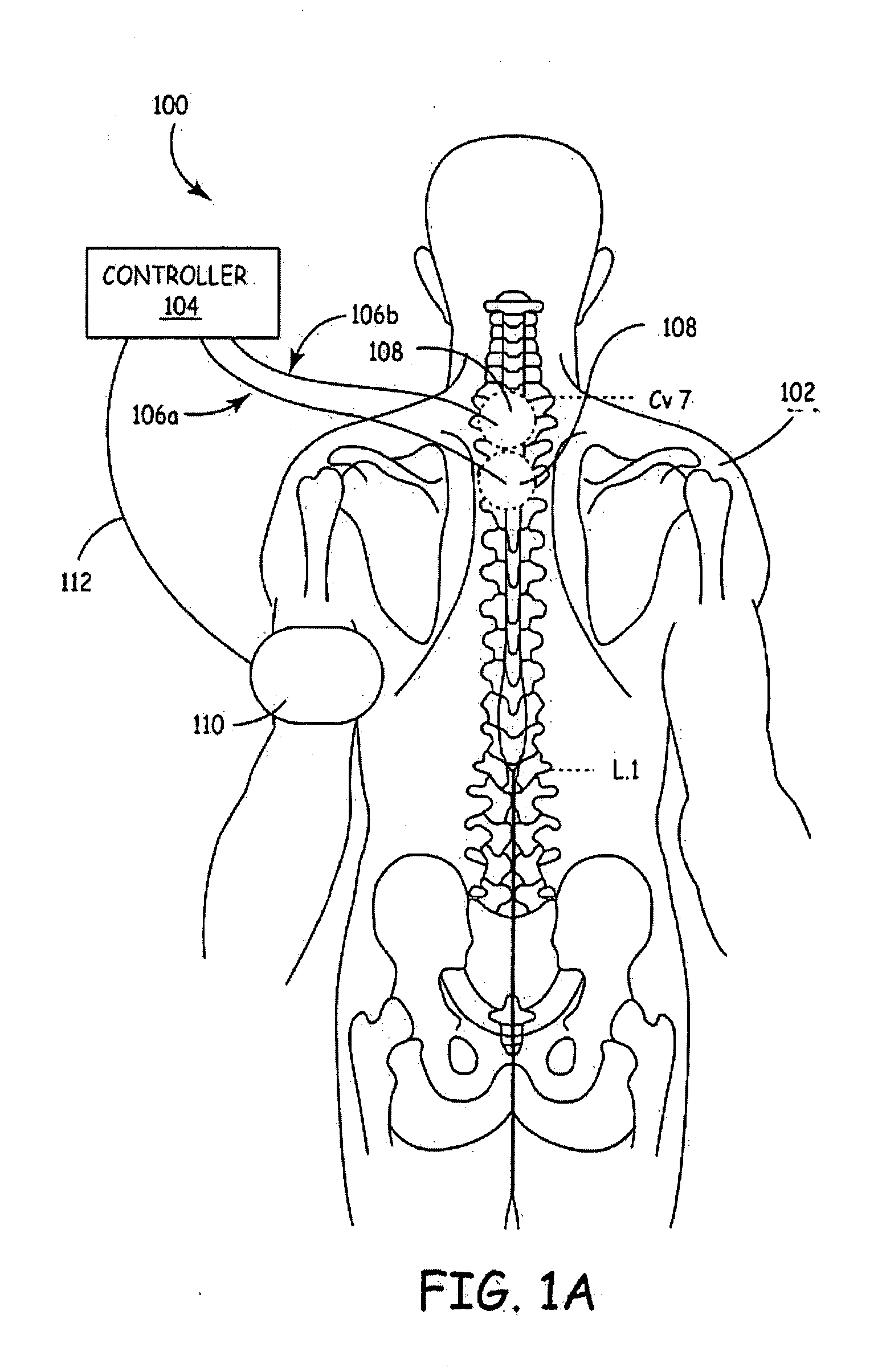 Method and apparatus to minimize the effects of a cardiac insult