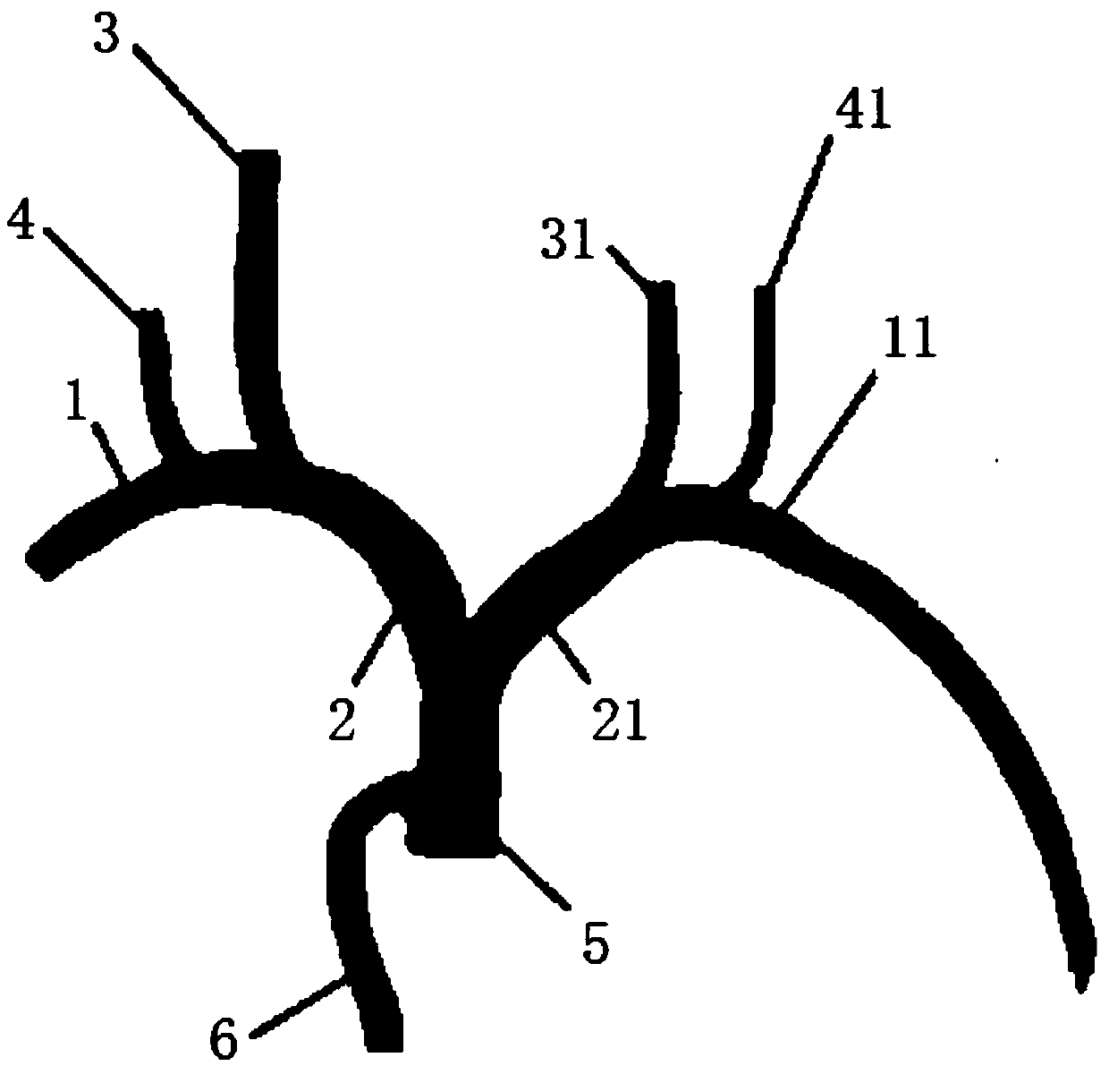 Subclavian vein puncture catheterization method