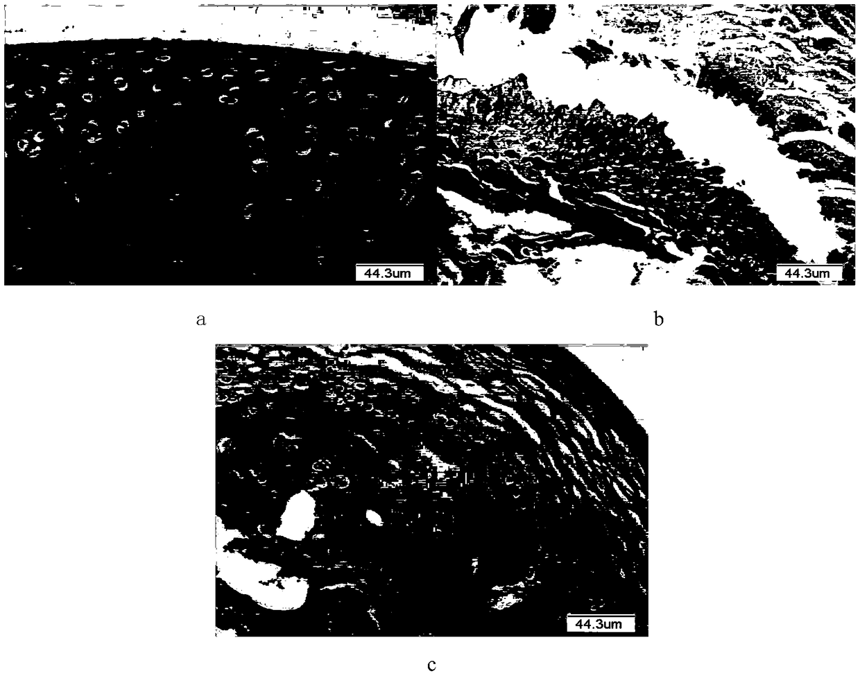 A scaffold material for treating femoral head necrosis and its preparation method