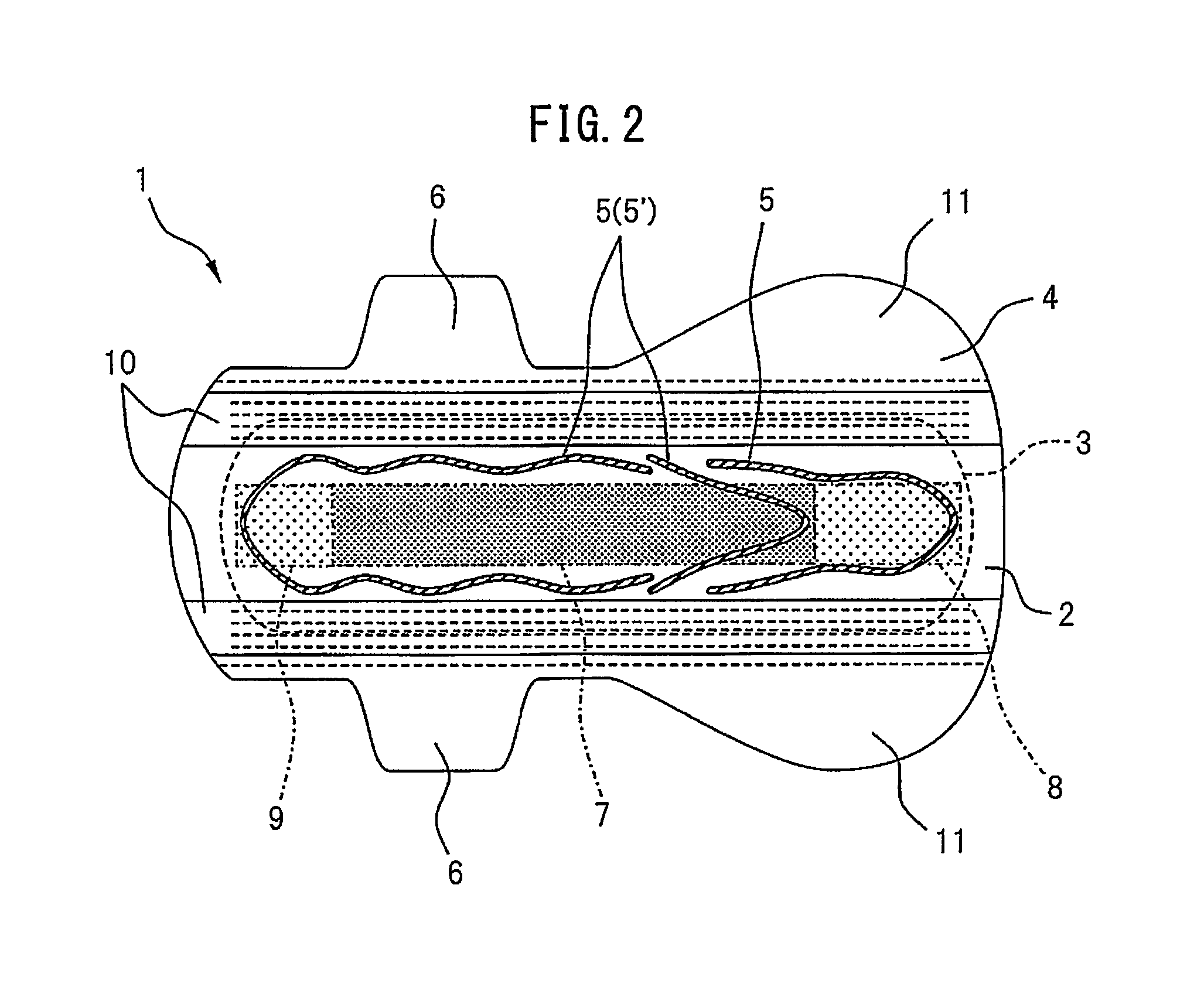 Absorbent article