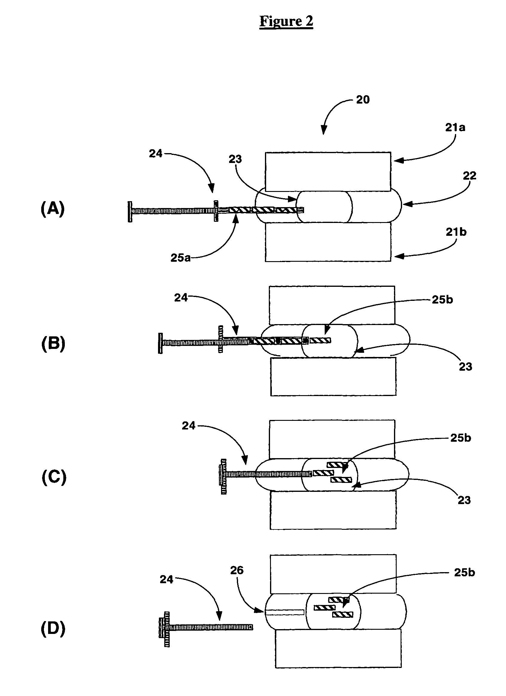 Rehydration and restoration of intervertebral discs with polyelectrolytes