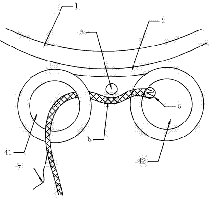 Minimally invasive comfortable urinary incontinence suspending tape device and application thereof