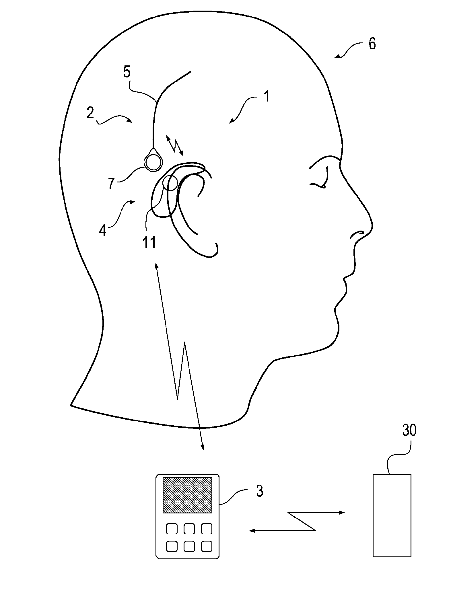 Portable eeg monitor system with wireless communication