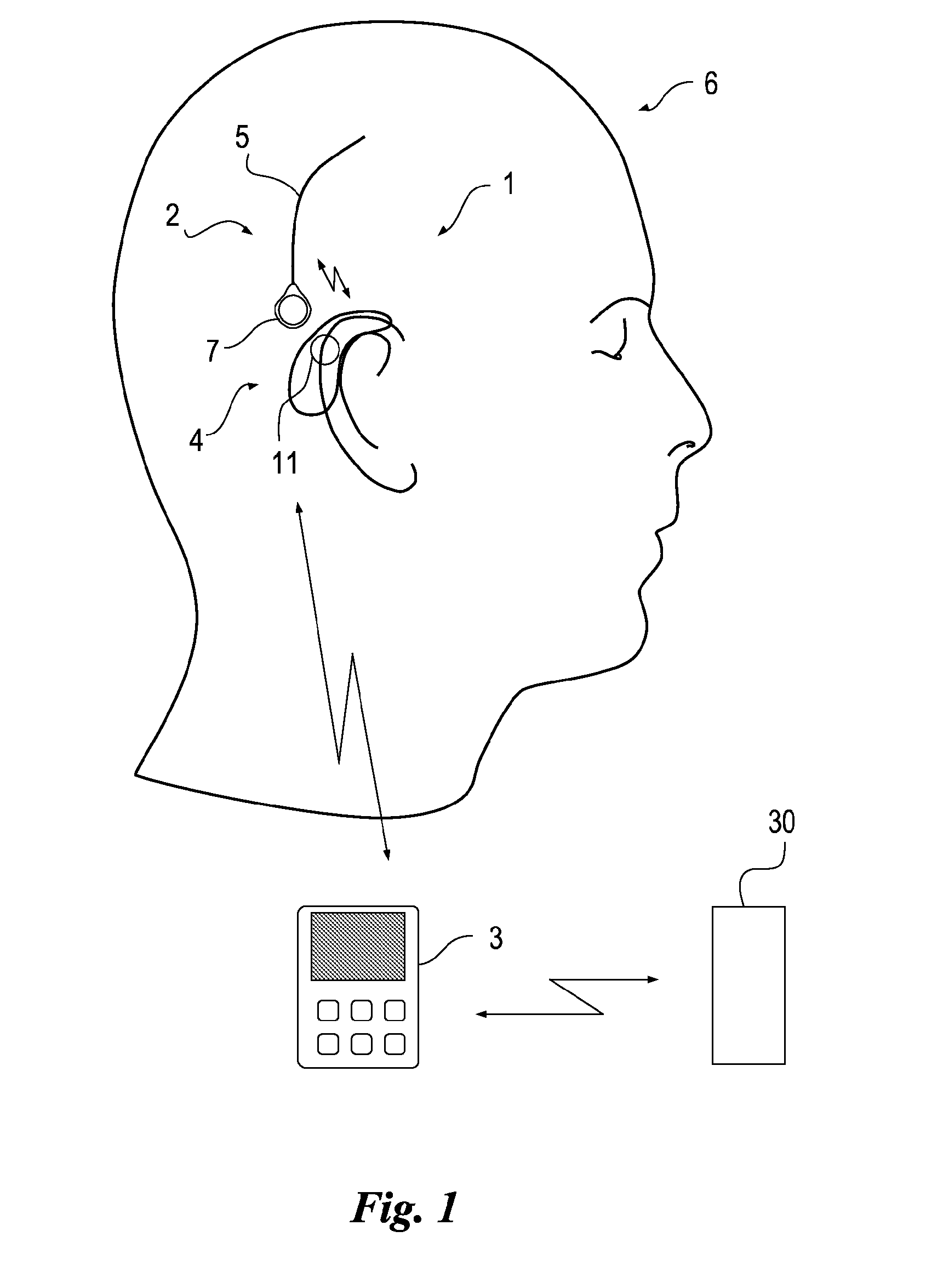 Portable eeg monitor system with wireless communication