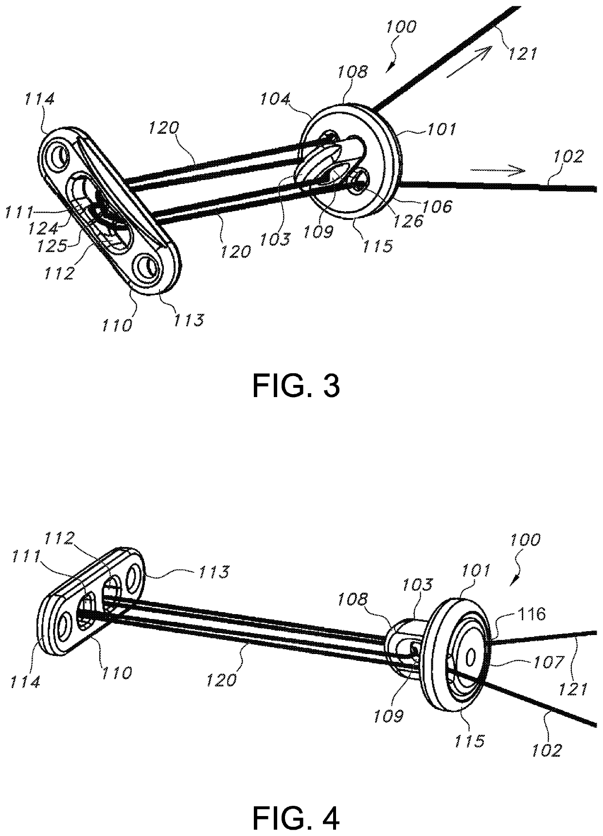 Knotless orthopedic stabilization system