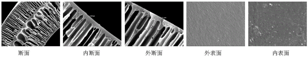 Hollow fiber ultrafiltration membrane