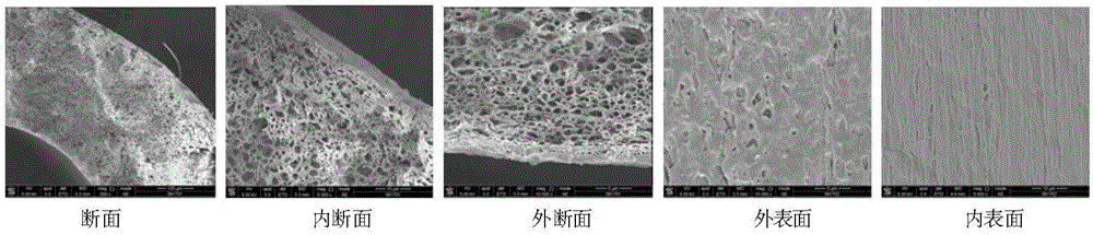 Hollow fiber ultrafiltration membrane