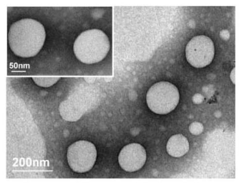 A targeted ultrasonic phase-change dual-mode imaging nano-contrast agent and its preparation method and application