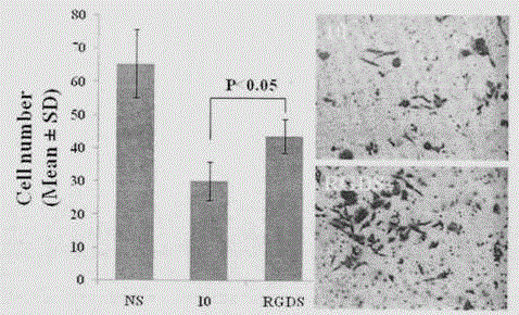 RGDS-modified curcumin and preparation, bioactivity and application thereof