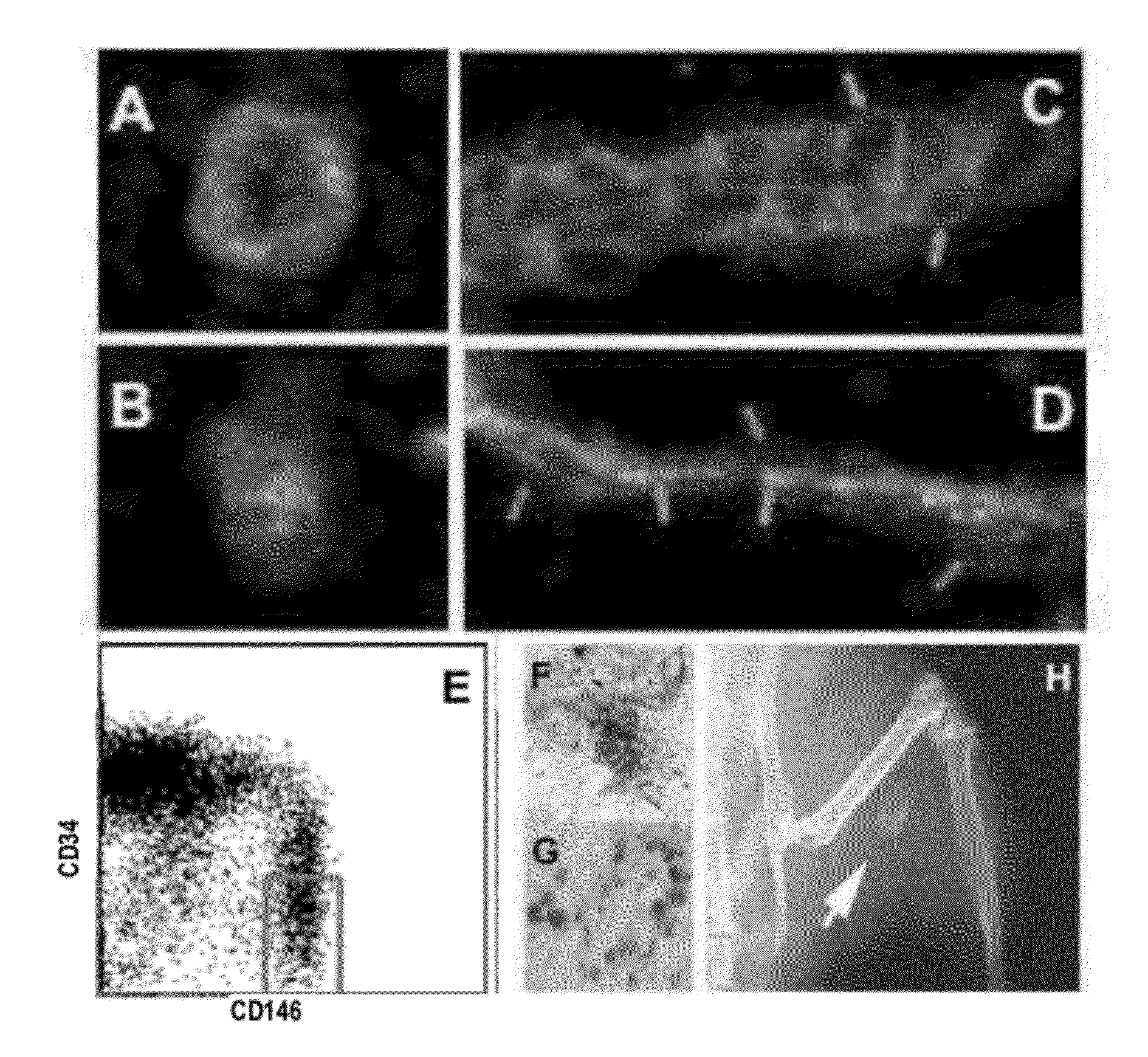 Perivascular Stem Cell Composition For Bone