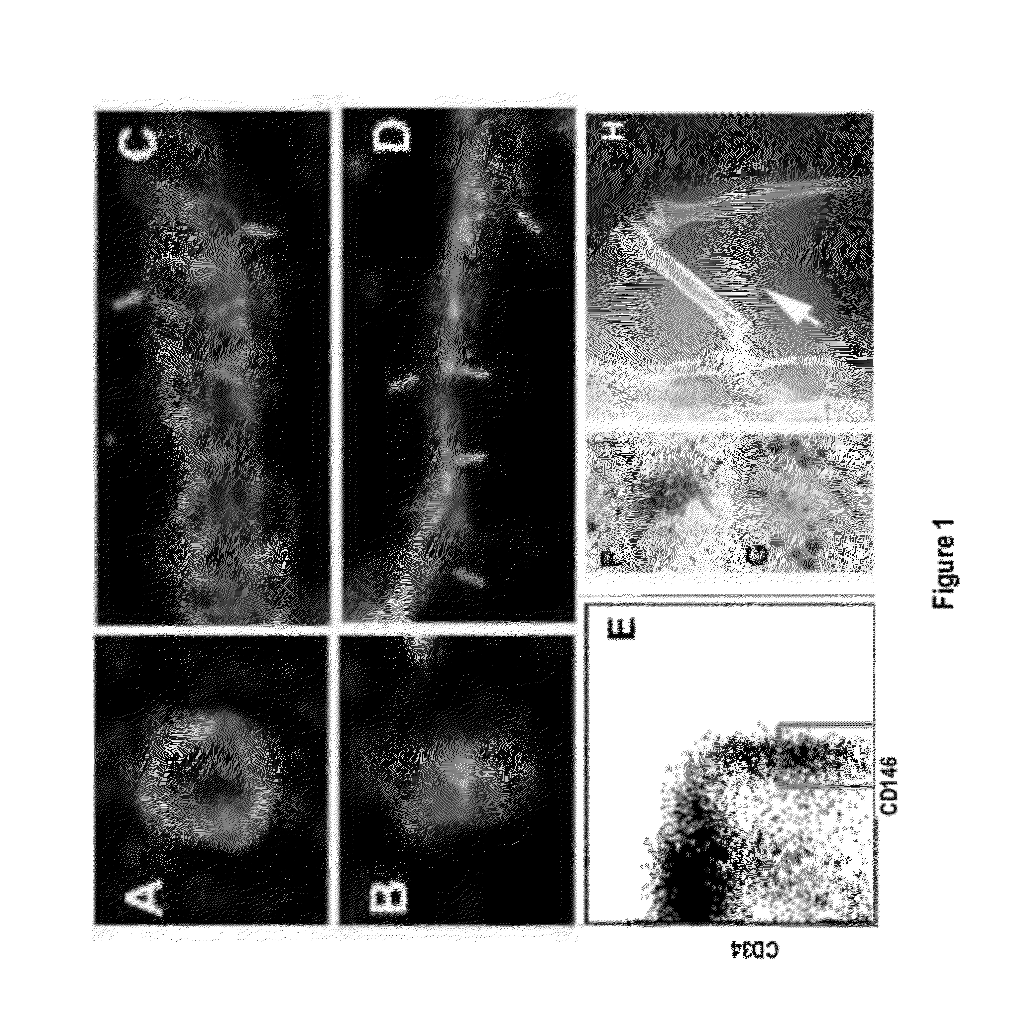 Perivascular Stem Cell Composition For Bone