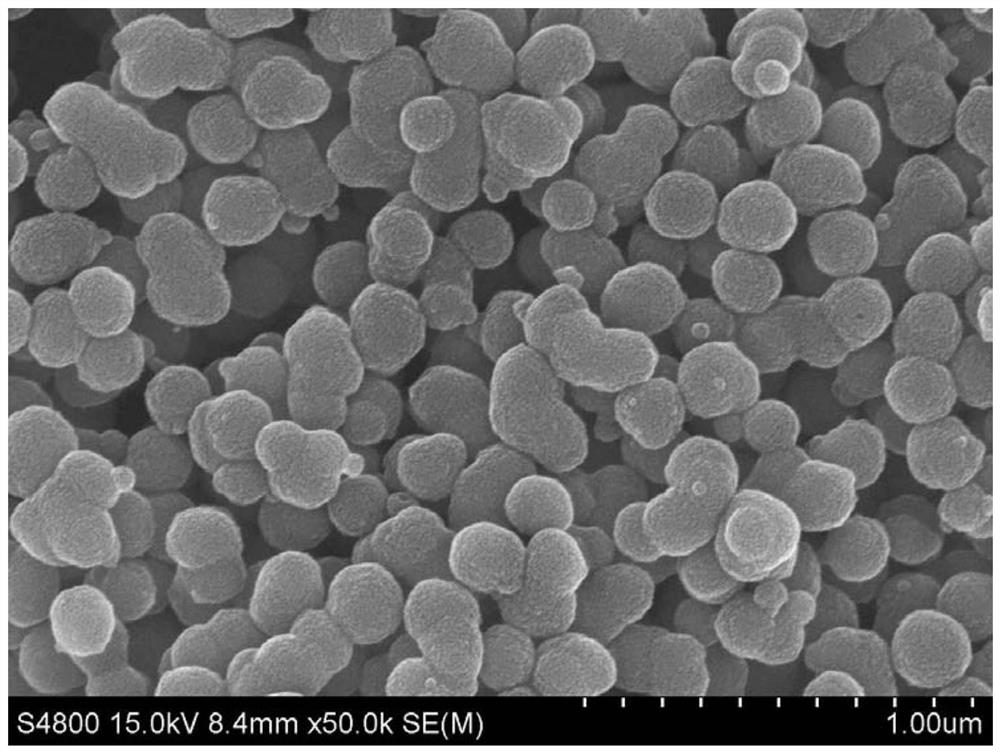 Preparation method of composite nanoparticle aluminum adjuvant